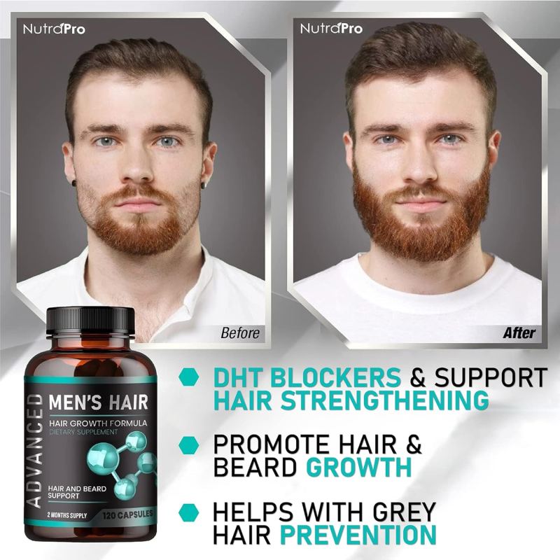 Hair Growth Vitamins for Men 120 Caps - Biotin & Saw Palmetto