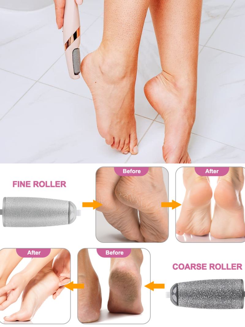 Electric Foot Grinder - Rechargeable Callus Remover with Vacuum