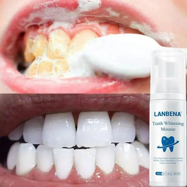 Lanbena Teeth Whitening Mousse - Removes Stains & Freshens Breath