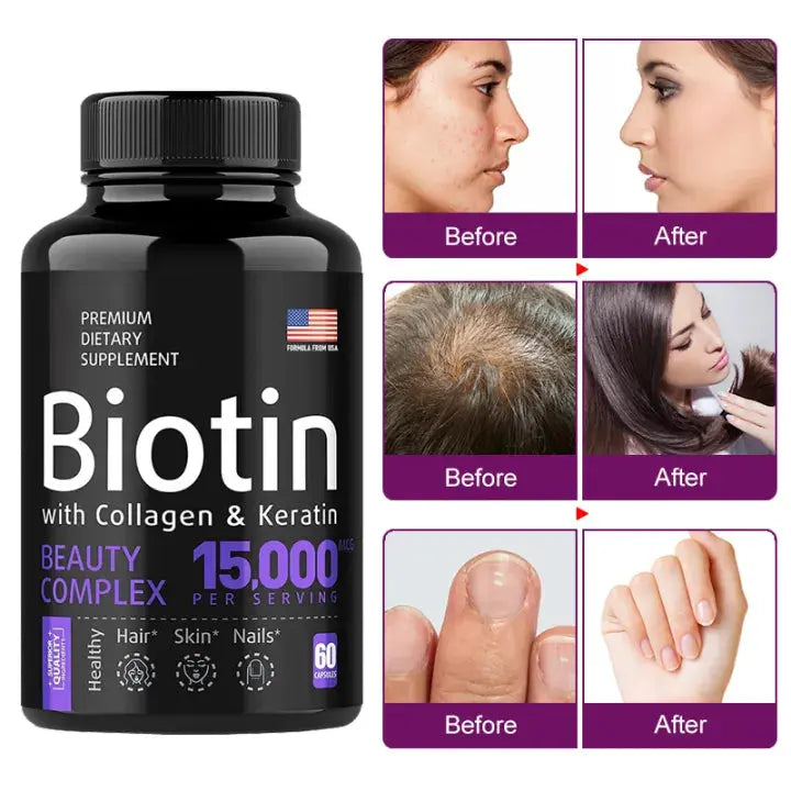 Biotin 15,000mcg with Collagen & Keratin - Hair, Skin & Nails