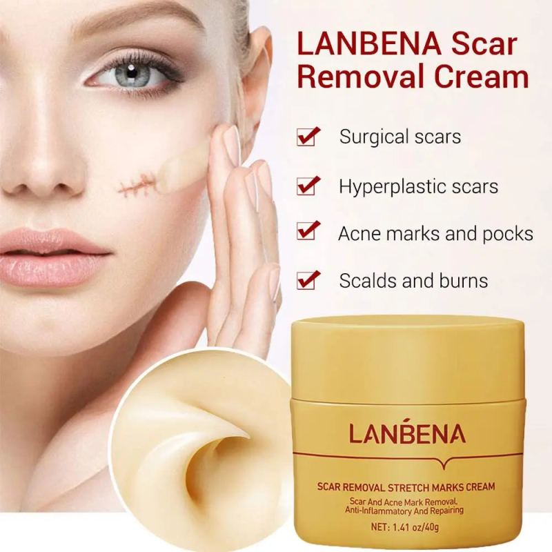 Lanbena Scar Removal Cream - For Scars, Stretch Marks & Burns