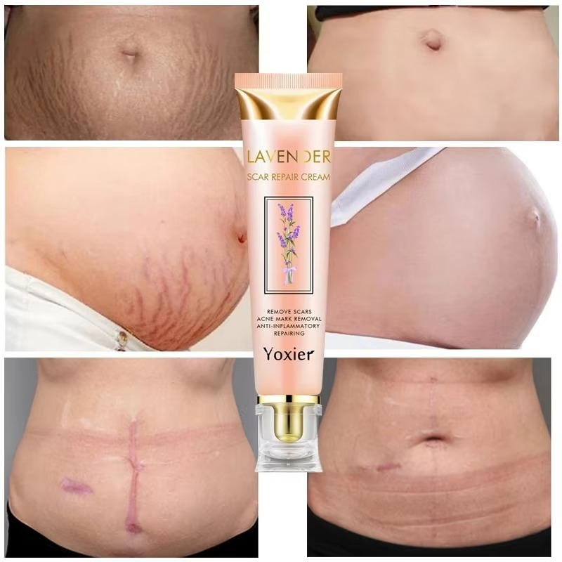 Yoxier Lavender Scar Repair Cream