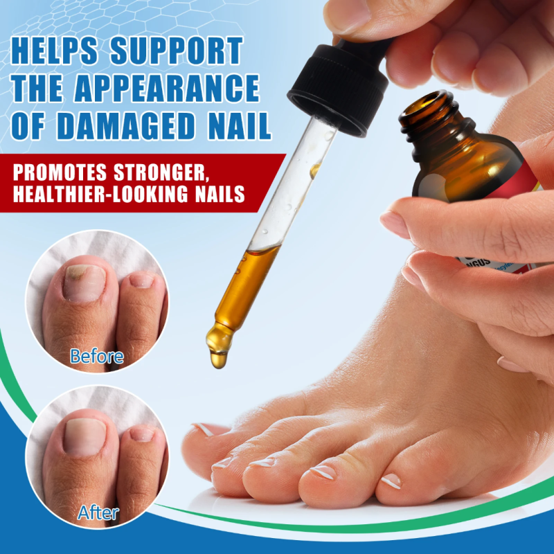 Toenail Fungus Treatment Extra Strength Nail Fungus Removal Solution Nail Repair Toe Nail Fungus Serum