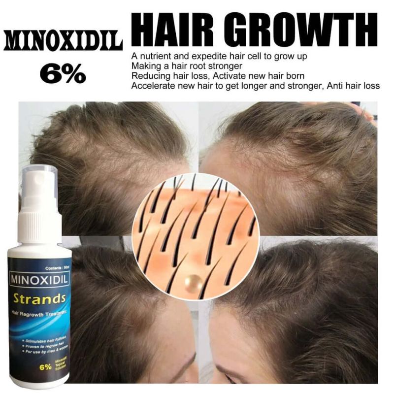 Minoxidil 6% Hair & Beard Growth Solution - Strands Topical Treatment